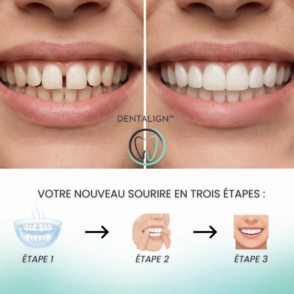 Dentalign™ : Le sourire parfait en quelques secondes - Dentalign